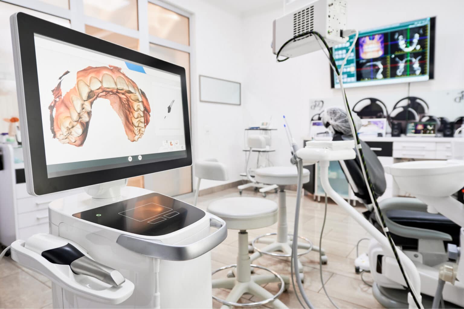 A modern dental clinic with advanced technology, showcasing digital dental impressions on a screen. Dental chairs and equipment are arranged neatly within the room.